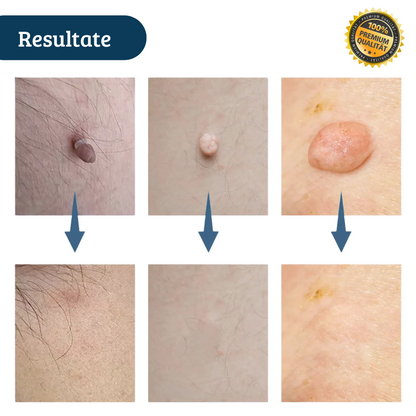 Dermaclean PRO - Dermatologisch getestet